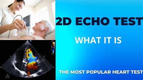 2d echo with cfds|2D ECHO Test .